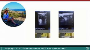 Перистальтика ЖКТ при патологиях