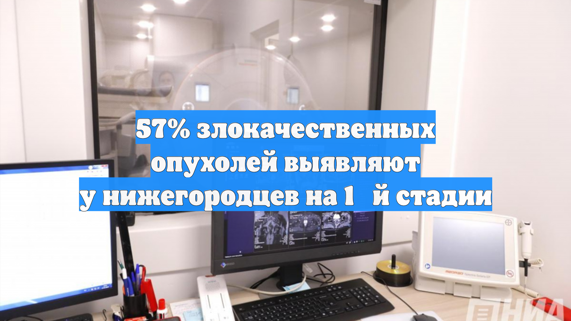 57% злокачественных опухолей выявляют у нижегородцев на 1‑й стадии