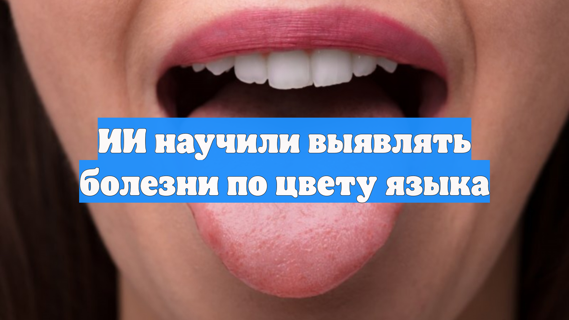 ИИ научили выявлять болезни по цвету языка