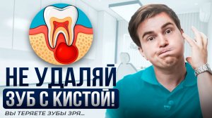 Киста на зубе — не приговор! Почему не нужно удалять зуб.