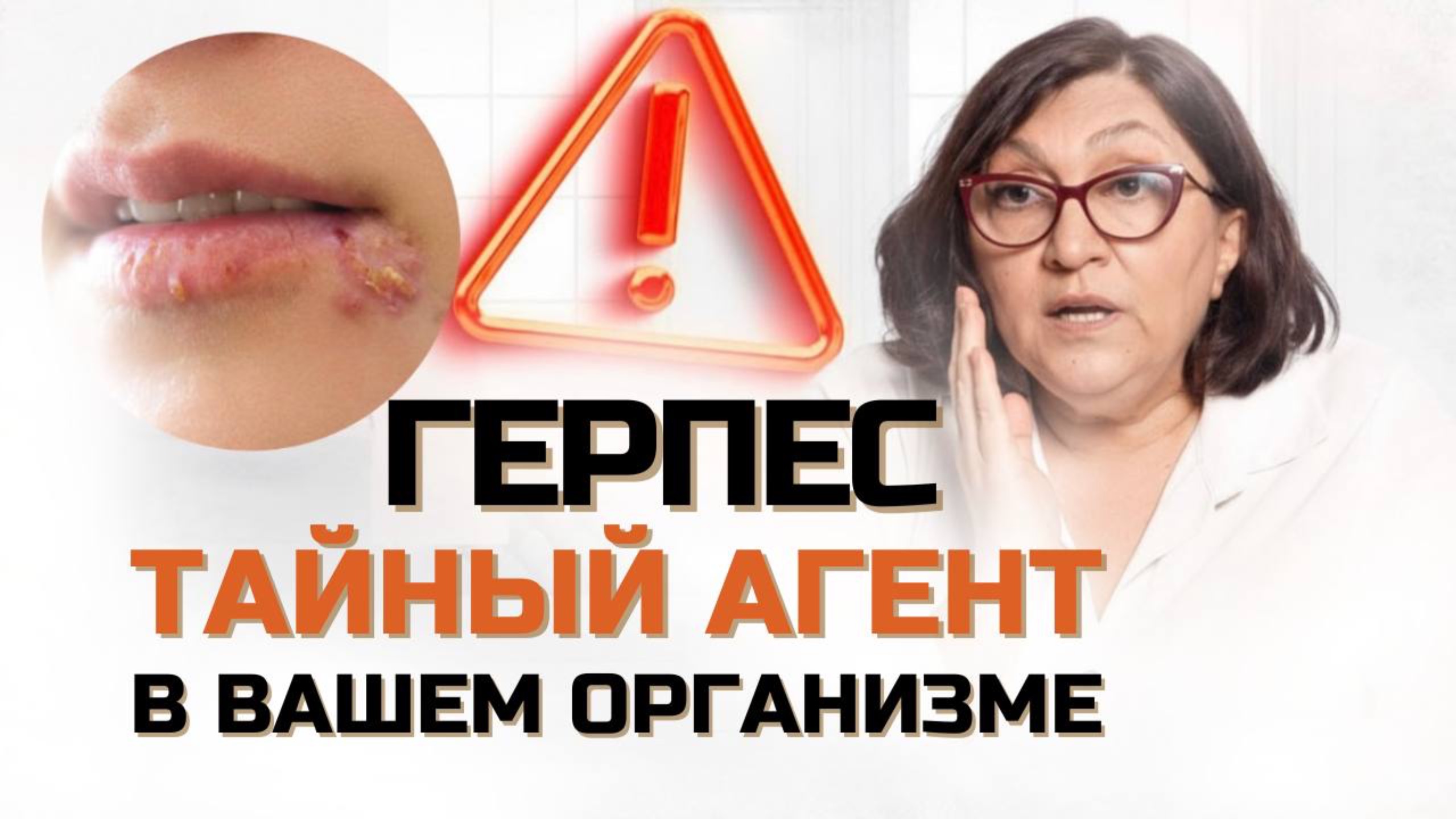 ГЕРПЕС - тайный агент вашем организме!
