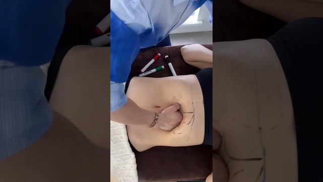 Массаж живота. Практика меняющее здоровье. 1 из 7 механизмов оздоровления биомашины.