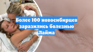 Более 100 новосибирцев заразились болезнью Лайма