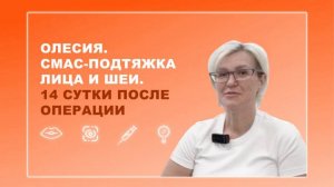 Олесия. Подтяжка лица и шеи. 14 сутки после операции