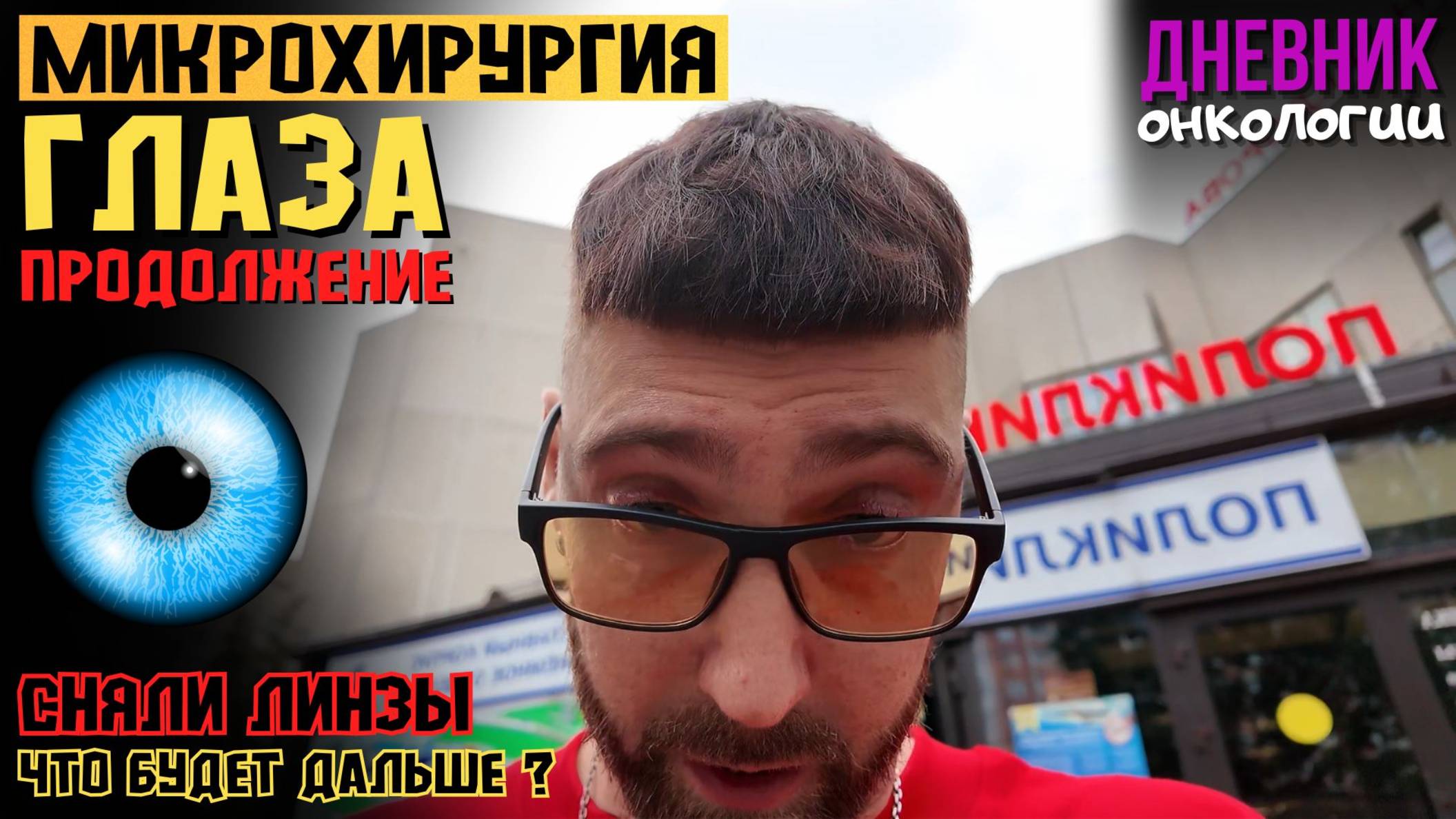 Опять микрохирургия глаза. Новости. Сняли линзы. Продолжаю капельницы. Рак крови. Жизнь в диагнозе