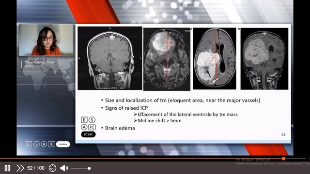 Neuroanatomy & Physiology And Neuroanesthesia