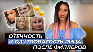 ПРАВДА О ФИЛЛЕРАХ // Филлеры гиалуроновой кислоты не рассасываются?