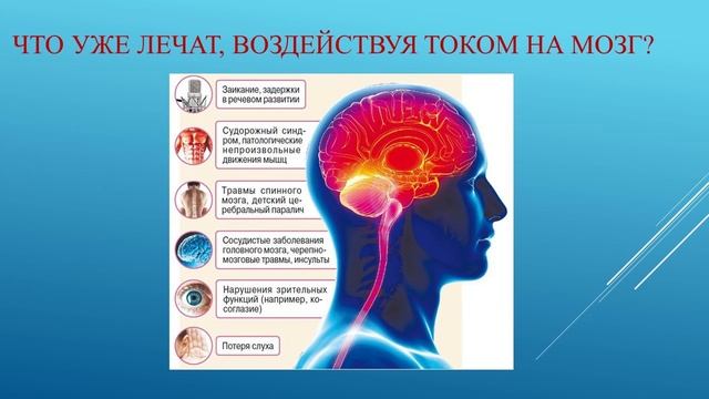 Микротоковая терапия смотреть онлайн