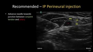 Блокда плечевого сплетения Подмышечным доступом