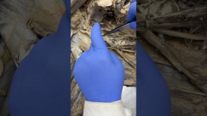 Черепные нервы14-10-2025