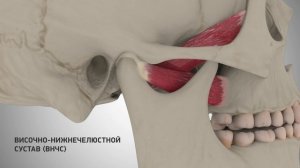 Возникновение щелчка в височно-нижнечелюстном суставе (ВНЧС)