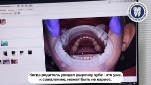Контактный кариес у детей — Сочихина Дарья Алексеевна