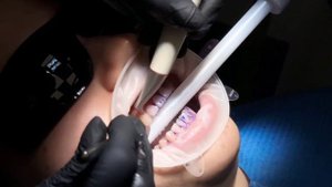 GBT протокол в ООО «Стоматологическая клиника фирма «Улыбка»