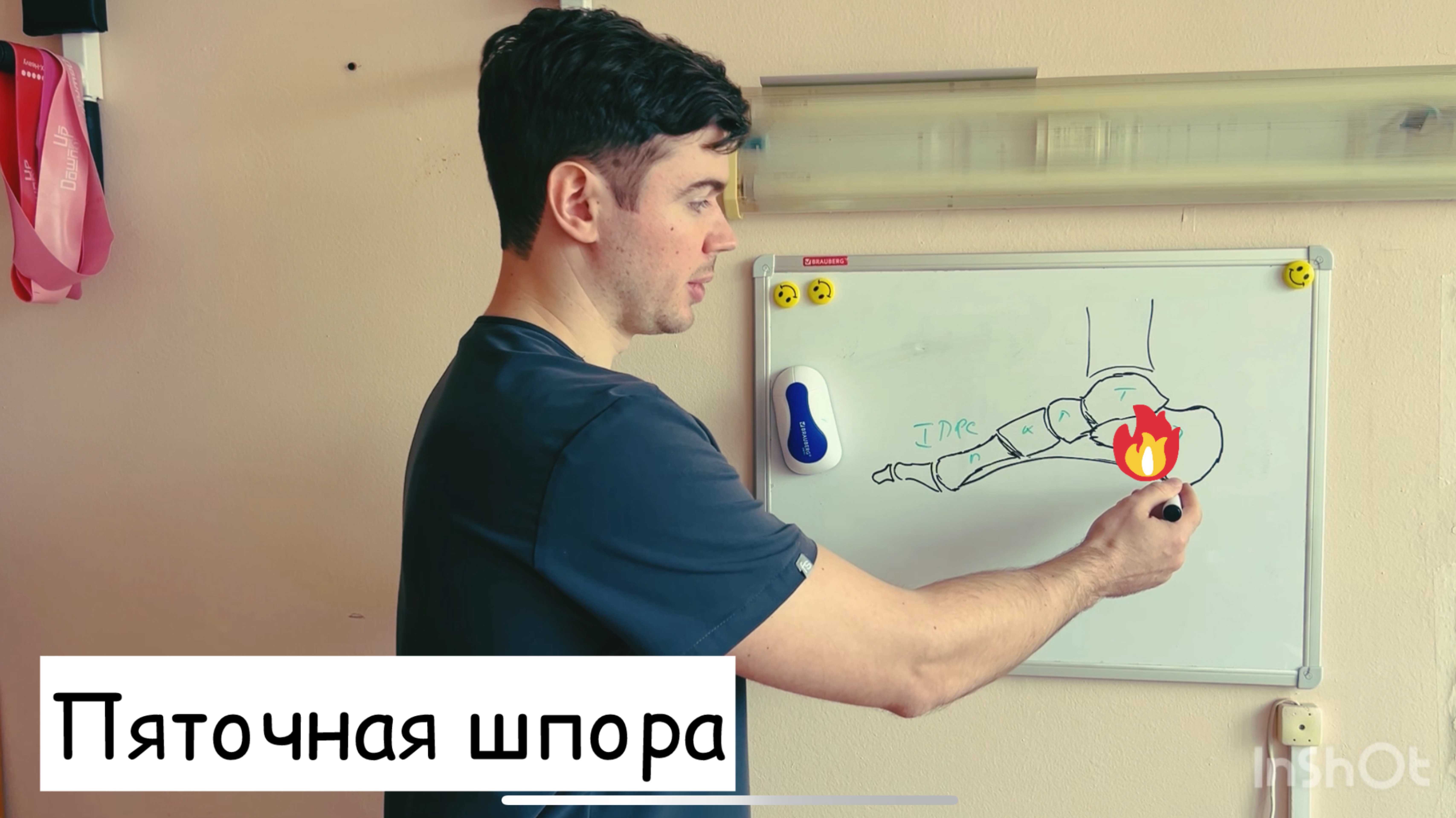 Плантарный фасциит и Пяточная шпора: полный гид по причинам симптомам и лечению.