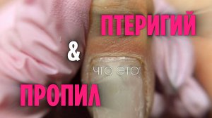 Перестаньте это спиливать! | Птеригий - это не пропил | Разбираем технику маникюра