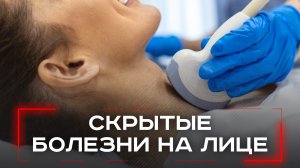 Как гормональные сбои меняют ваше лицо: 5 тревожных признаков, о которых вы не догадывались