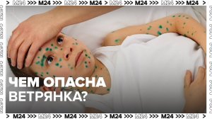 В России выросло число случаев заболевания ветрянкой — Москва 24 | Контент