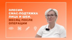 Олесия. СМАС-подтяжка лица и шеи. Месяц после операции