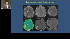 Учебный курс «Нозокомиальные инфекции в нейрохирургии».