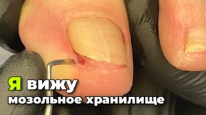 Вытащить угол