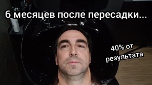 Пол года после пересадки. Что с доноркой?