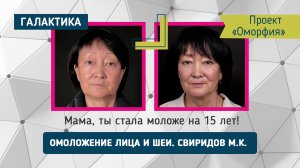 Проект "Оморфия": Омоложение лица и шеи у Свиридова | «Мама, ты помолодела на 15 лет!»