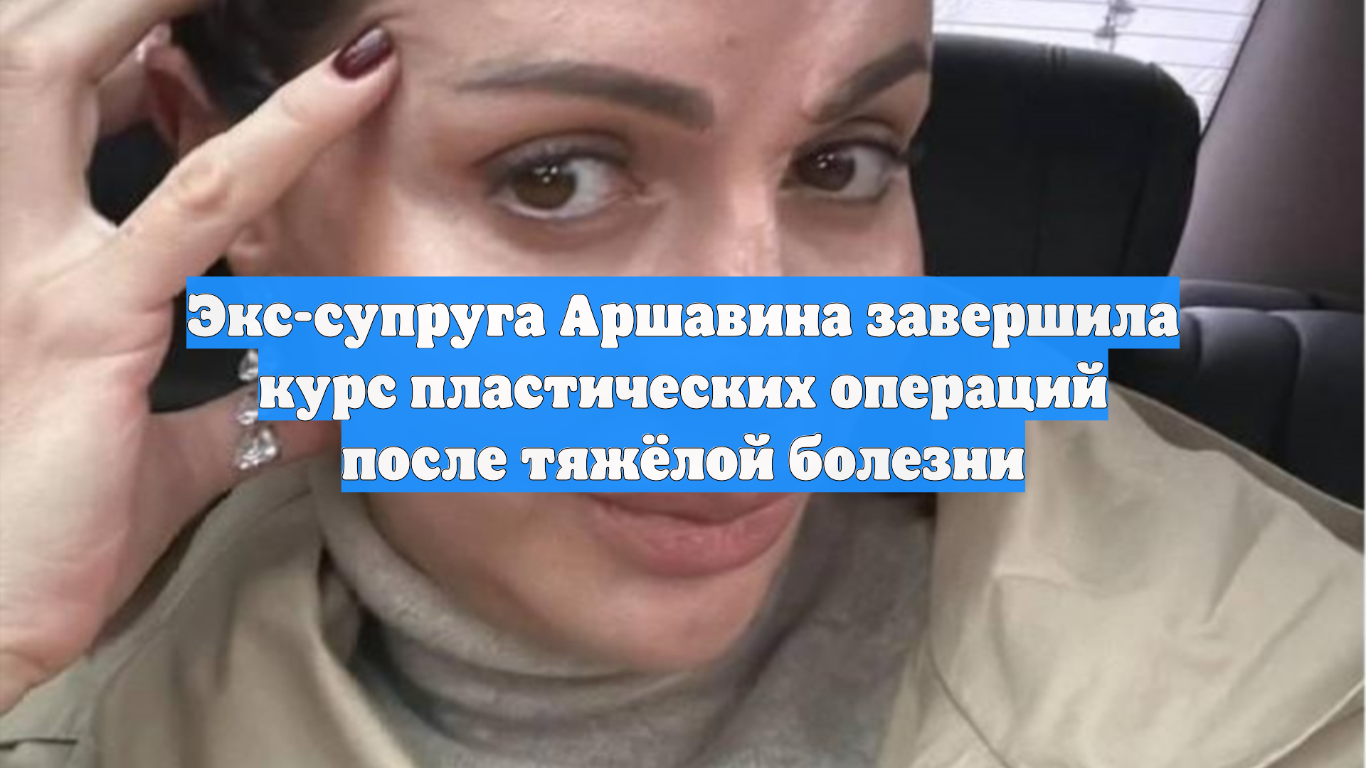 Экс-супруга Аршавина завершила курс пластических операций после тяжёлой болезни
