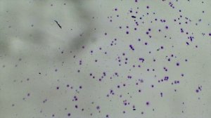 Мужские хромосомы под микроскопом