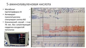Интраоперационная арт гипотензия как фактор риска п-о осложнений Курбасов А.А. 2024