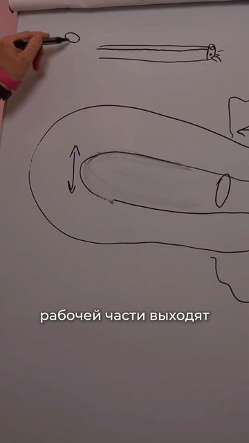 Гистероскоп: как удаляют полипы без разрезов? смотреть онлайн