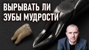 Почему не стоит вырывать зубы мудрости или лучше их сохранить? Феноменальная физиогномика