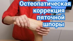 Остеопатическая коррекция пяточной шпоры
