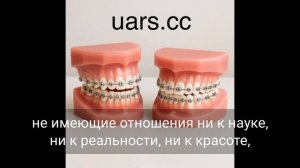 Лечение ССВДП\UARS