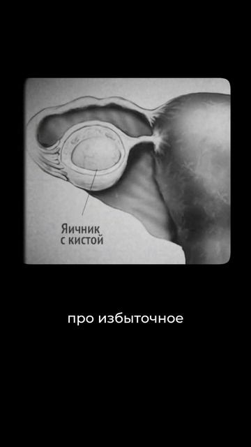 Кисты яичников: почему они ускоряют старение и снижают шанс на беременность смотреть онлайн