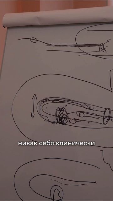 Все ли полипы нужно удалять? Ошибается большинство смотреть онлайн