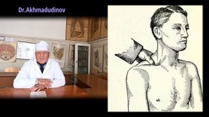 Операции на сосудах. Часть 1 Профессор Ахмадудинов М.Г.