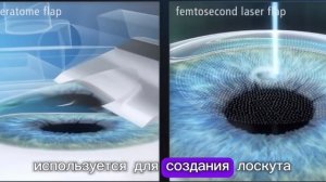 ЛАСИК и ФемтоЛАСИК
