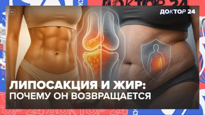 Липосакция и жир: почему он возвращается и какой на самом деле опасен