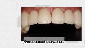 Отзыв Патрика Ш. (Швейцария) о проведенном лечении в БИЭМ