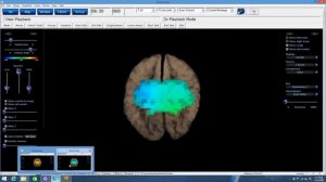 Обзор _до_ и _после_ сессии #accessbars от нейробиолога доктора Джеффри Феннина и Гари Дагласа