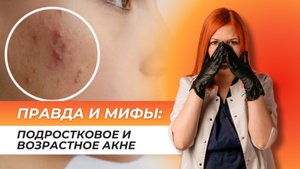 ПРАВДА И МИФЫ: Подростковое и возрастное акне