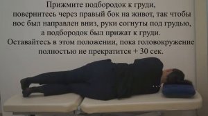 Ролл-маневр (Барбекю-маневр, маневр Лемперта) при ДППГ левого горизонтального полукружного канала