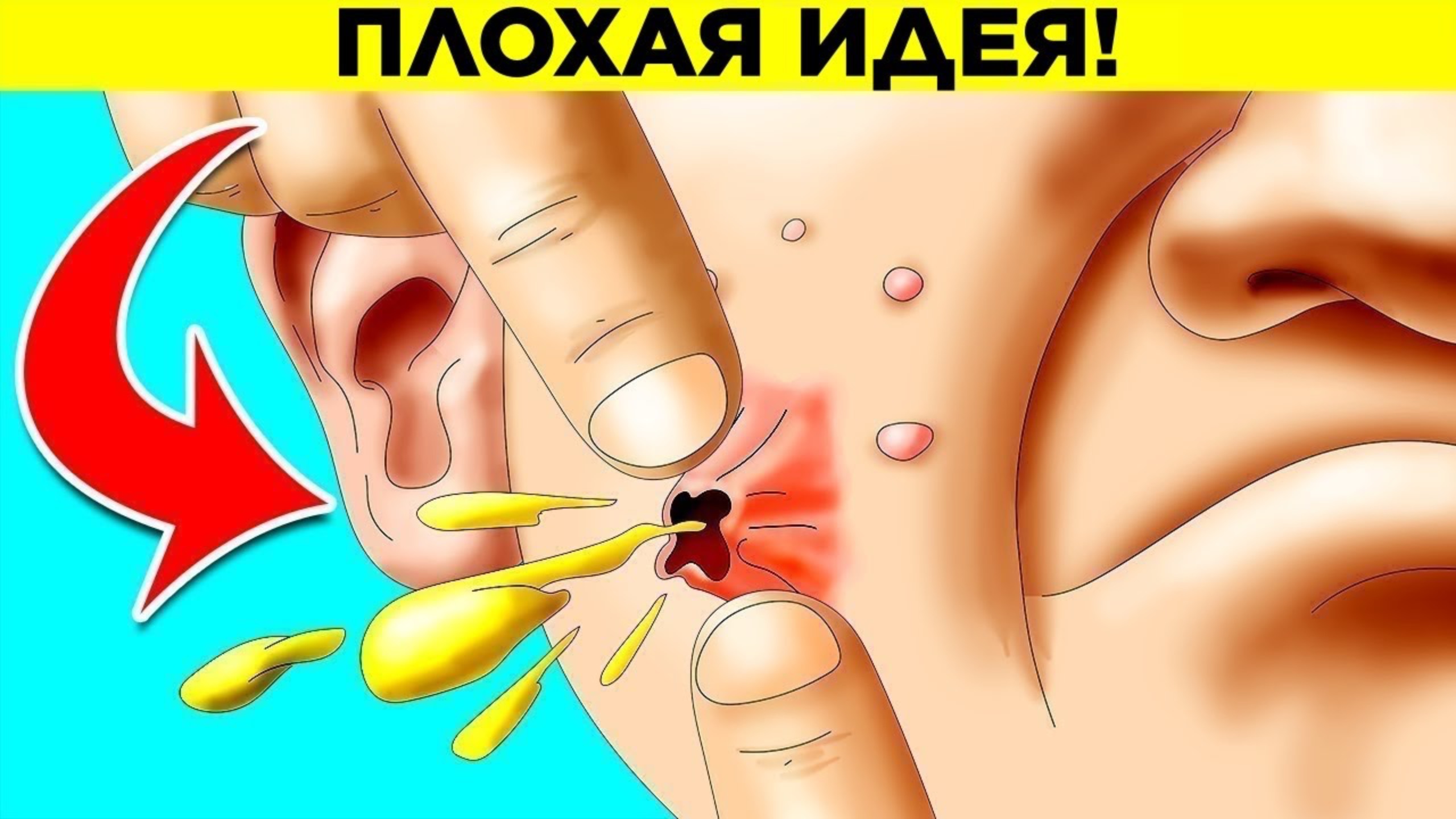 Почему нельзя выдавливать прыщи? Парад Фактов 17 смотреть онлайн