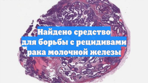 Найдено средство для борьбы с рецидивами рака молочной железы