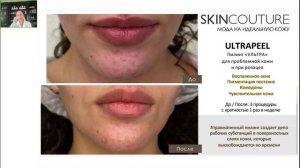 Профессиональные пилинги и уникальные авторские программы SKINCOUTURE. Обзорный вебинар