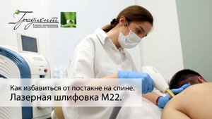 Как избавиться от постакне на спине с помощью лазерной шлифовки на М22 Resur FX