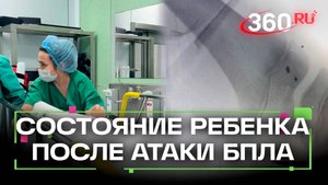 Главврач Центра Рошаля рассказала о состоянии мальчика, пострадавшего от атаки БПЛА на Красногорск