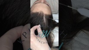 Холодная плазма