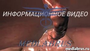 Удаление аппендикса: современные методы и показания. Аппендэктомия