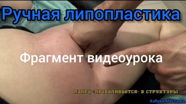 Ручная Липопластика(Липосакция)